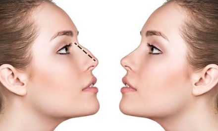 Rinoplastia – o interventie chirurgicala  cu multiple beneficii