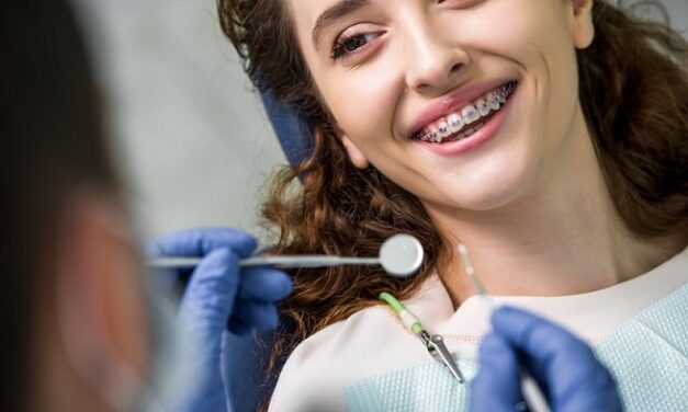 Ce trebuie sa stii despre albirea dentara dupa indepartarea aparatului dentar