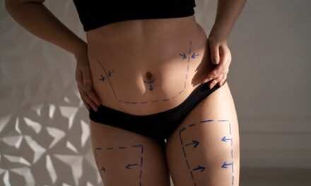 5 aspecte inestetice ale corpului care pot fi remediate cu ajutorul chirurgiei