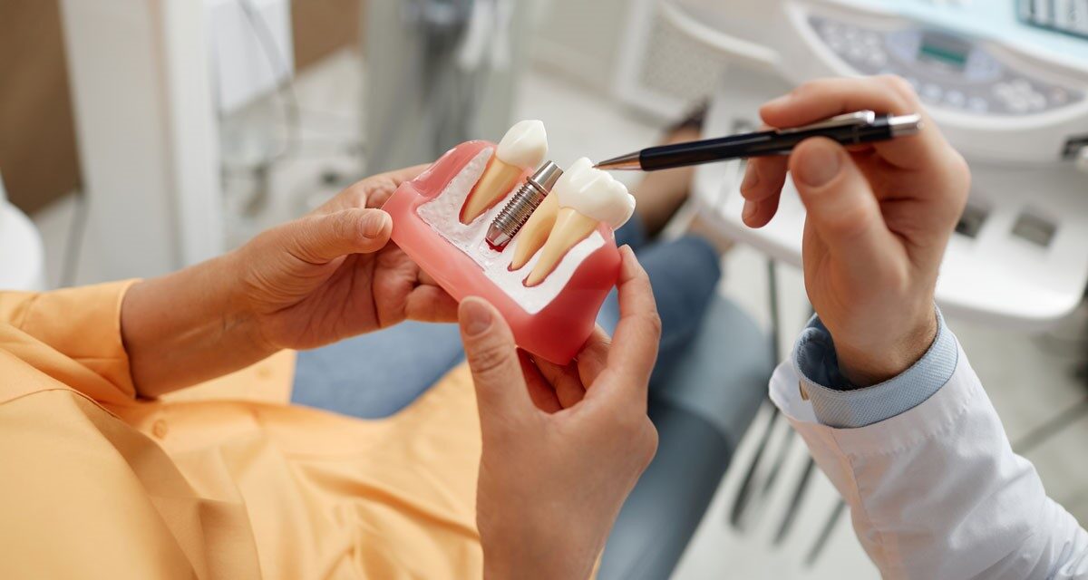 Ce factori influențează prețul unui implant dentar: La ce să fii atent?