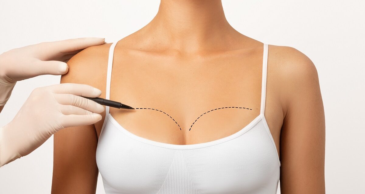 Lifting mamar vs. alte proceduri de conturare a sânilor: cum să faci alegerea potrivită?