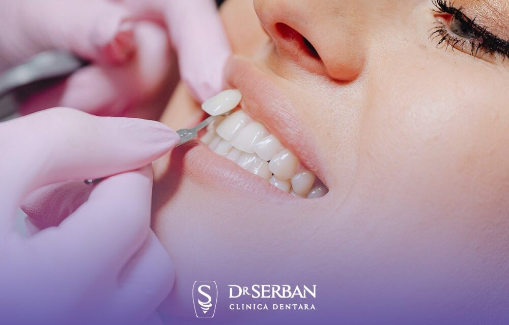 Pot fațetele ceramice să schimbe prima impresie la interviu sau în afaceri, mai ales în București?