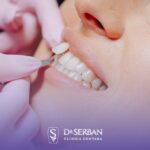 Pot fațetele ceramice să schimbe prima impresie la interviu sau în afaceri, mai ales în București?