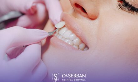 Pot fațetele ceramice să schimbe prima impresie la interviu sau în afaceri, mai ales în București?